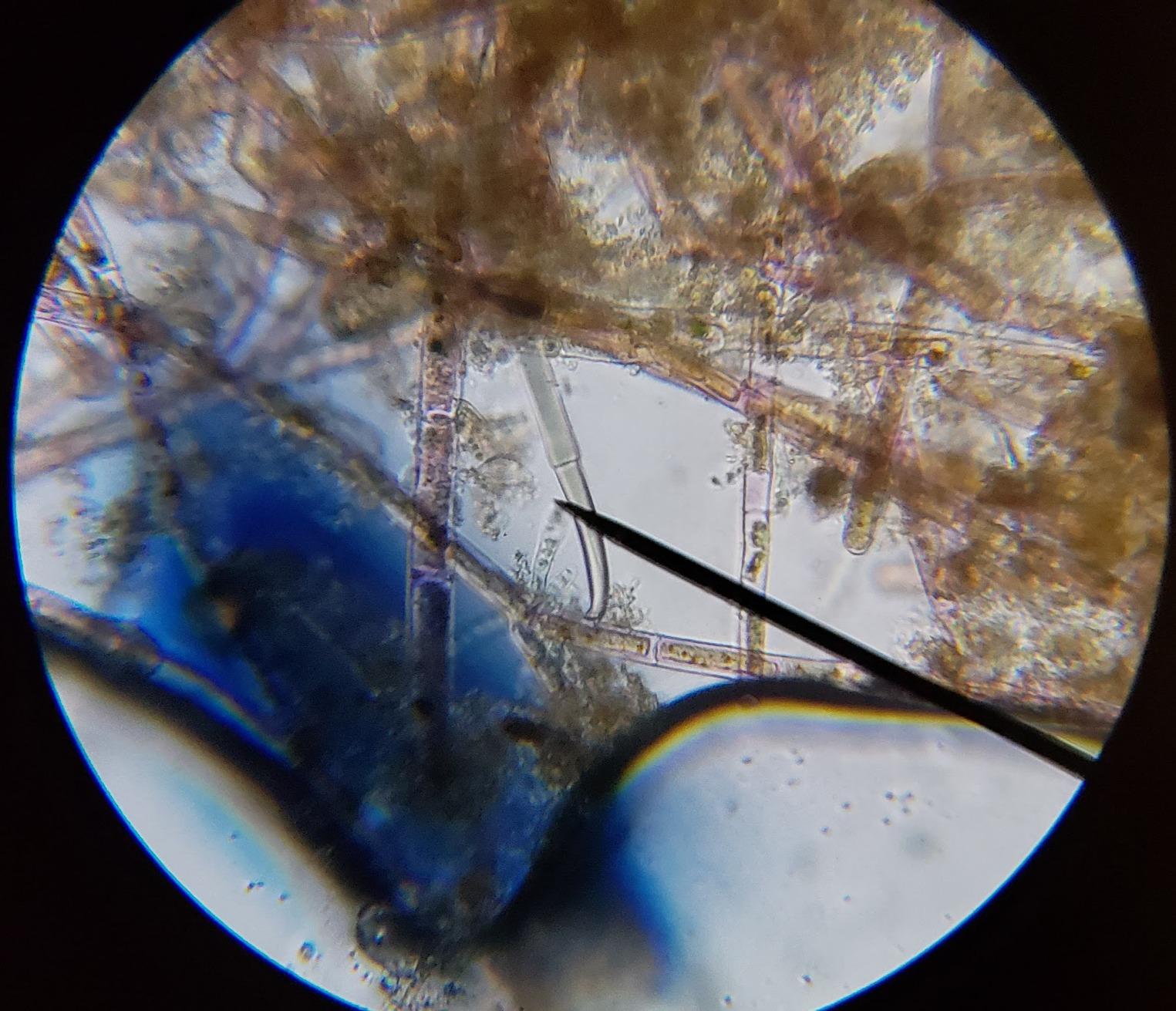 AmScope M150C/M150C-I 40X-1000X All-Metal Optical Glass Lenses Cordless LED Student Biological Compound Microscope customer photo 1