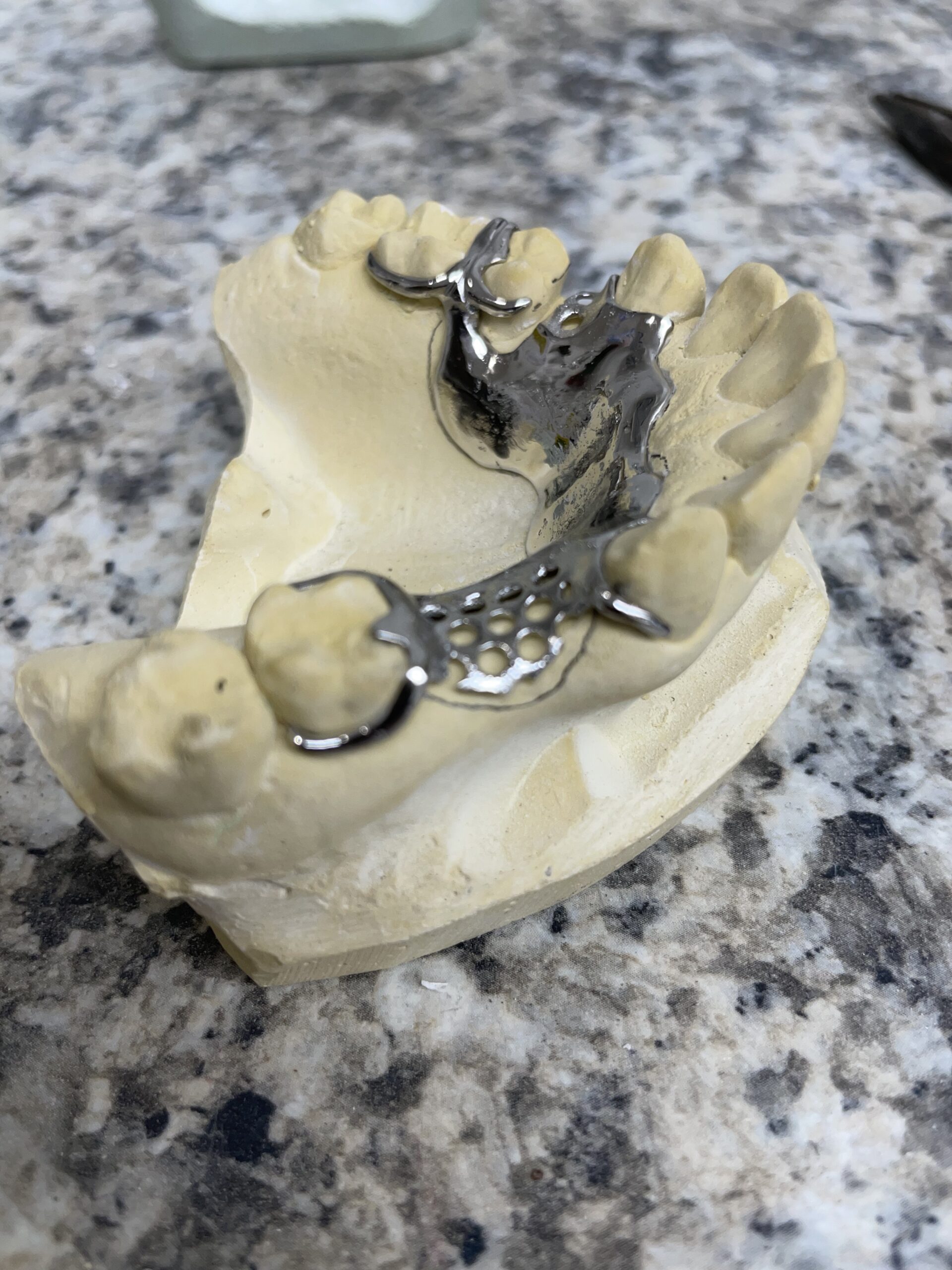 Dental Castable Resin UV Photopolymer Resin 405nm Ultra Low Shrinkage, Easy Casting for Dental implant Restoration Frame & Crown 500G customer photo 1