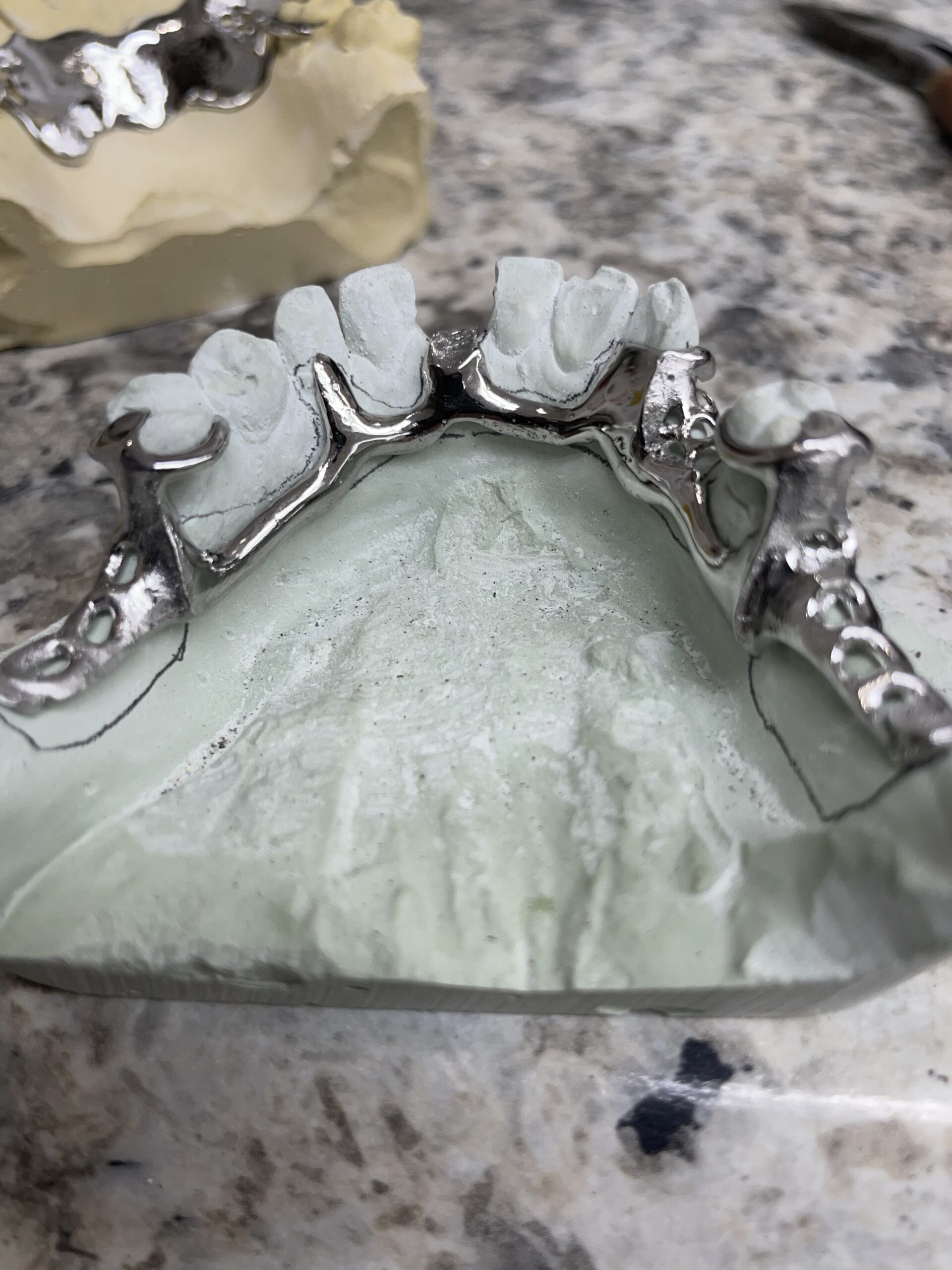 Dental Castable Resin UV Photopolymer Resin 405nm Ultra Low Shrinkage, Easy Casting for Dental implant Restoration Frame & Crown 500G customer photo 2