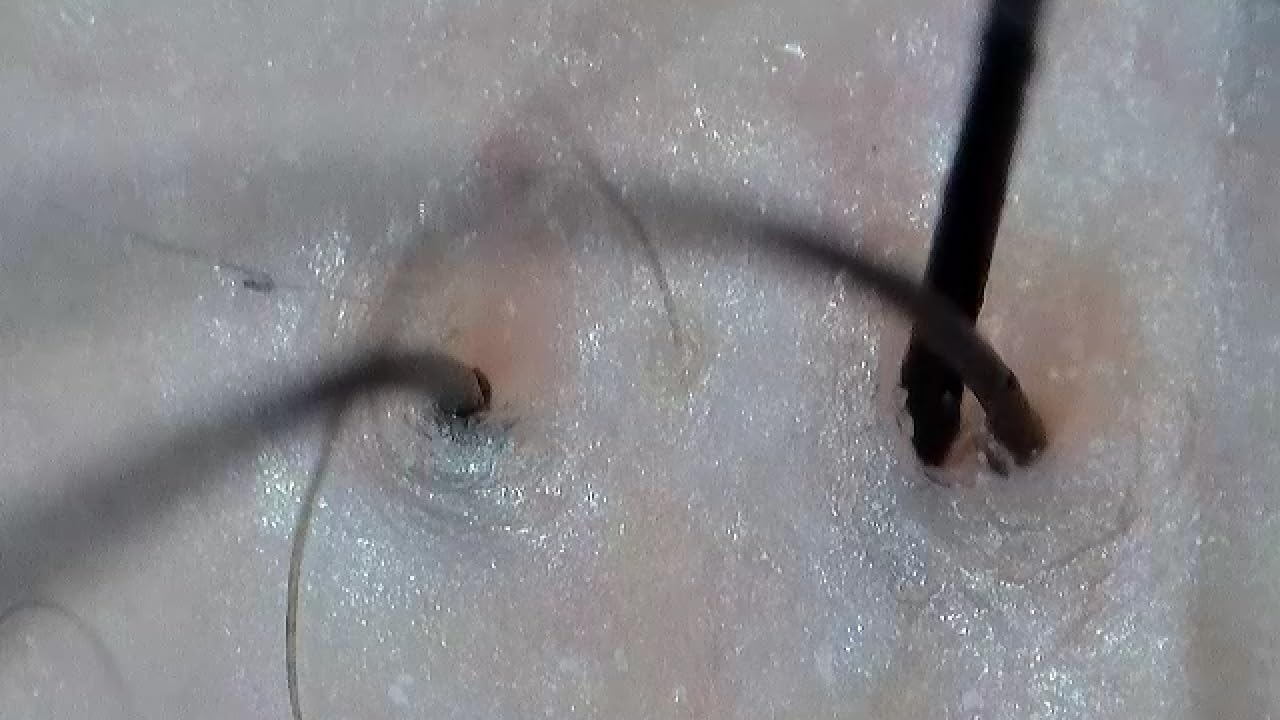 Jiusion WiFi USB Digital Handheld Microscope, 50 to 1000x Wireless Magnification Endoscope 4K 3840x2160P Camera 8 LEDs with Metal Stand for iPhone iPad Android Mac Windows Linux Chrome customer photo 1