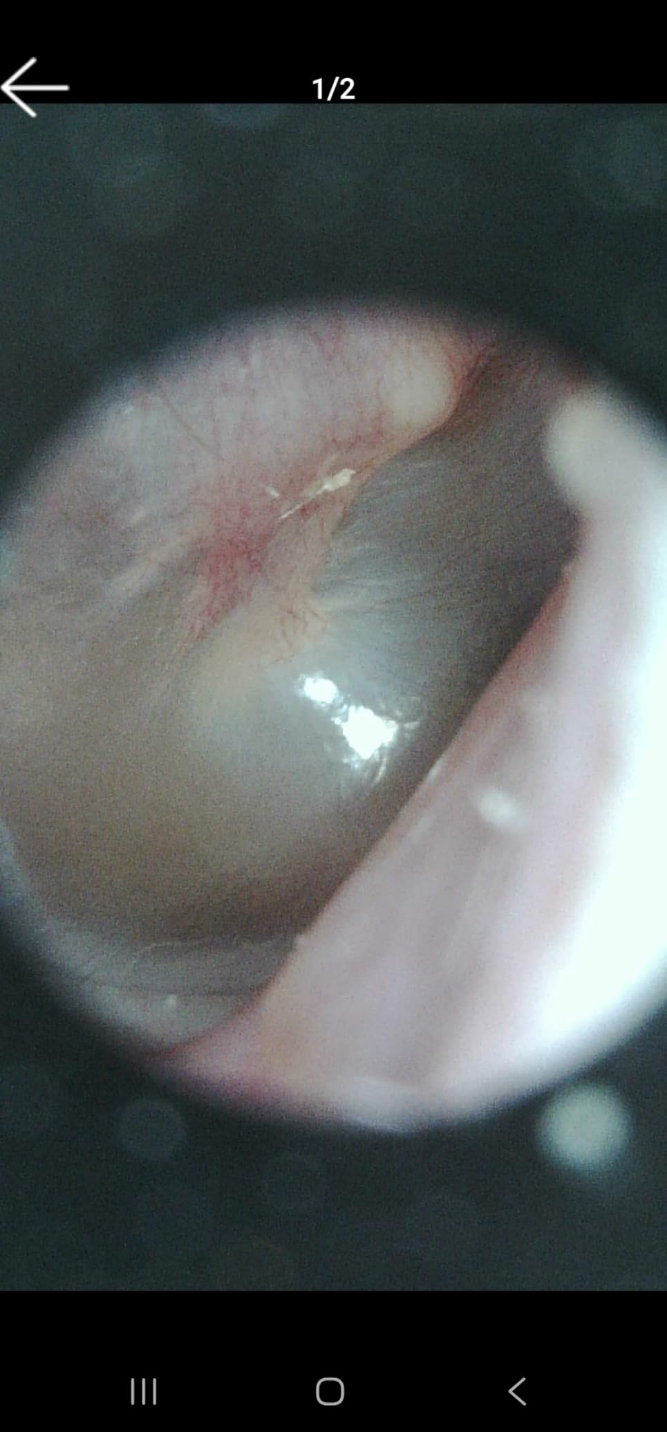 Teslong USB-C Digital Microscope, 10X to 200X Magnification Portable Camera with 8 LED Lights, Handheld Rotating Metal Stand for Coin, Electronic, Compatible with iPhone 15+ and Android Devices customer photo 1