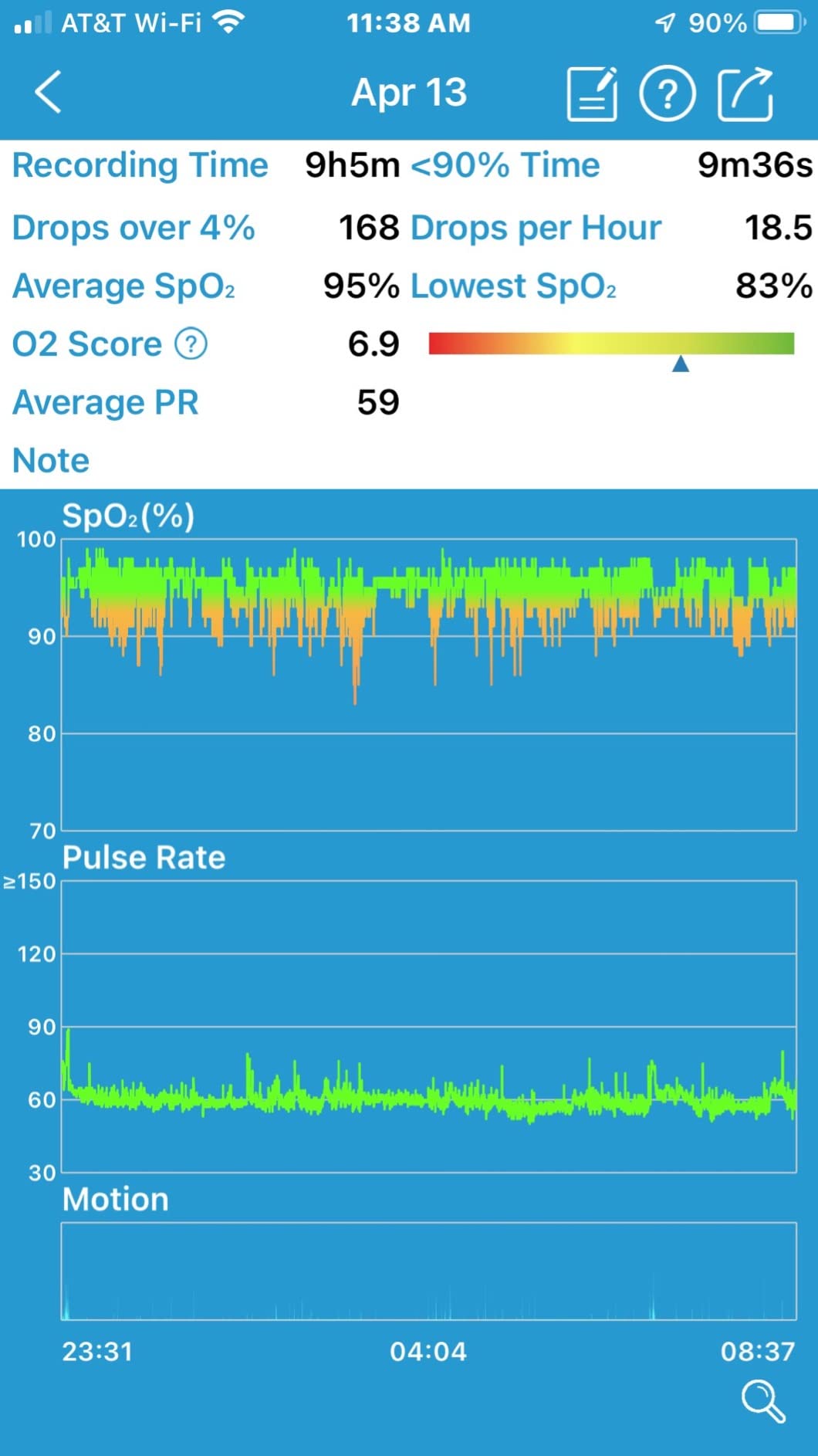 LOOKEE O2-Tracker Ring Continuous Pulse Oximeter - Wearable Oxygen Monitor with Vibration Reminder for Low O2 - Rechargeable Blood Oxygen Saturation SpO2 Meter - Free APP with Reports customer photo 1