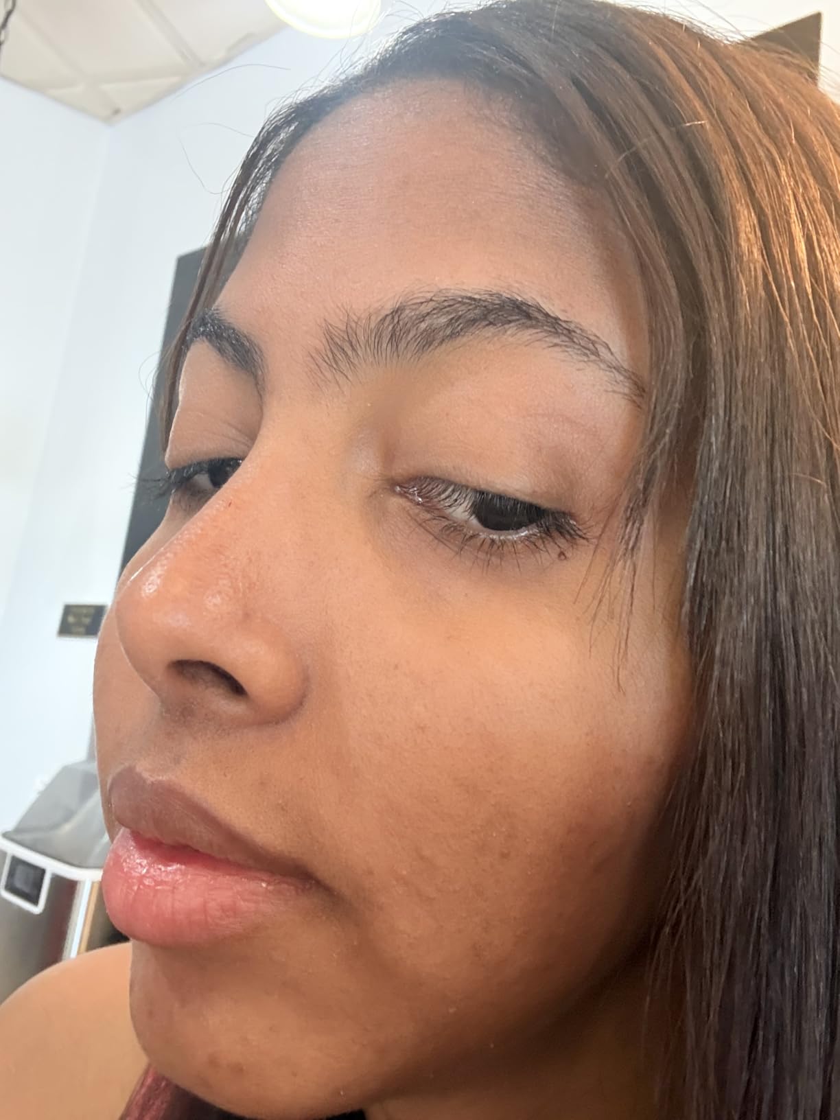 EltaMD UV Clear Face Sunscreen SPF, Oil-Free Sunscreen with Zinc Oxide, Dermatologist Recommended customer photo 2