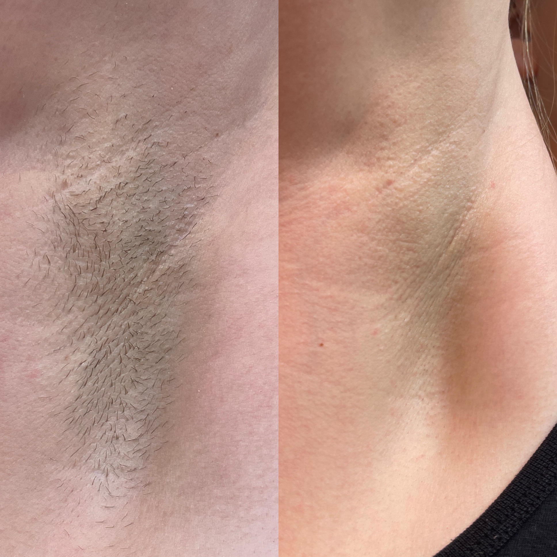 Remington Smooth and Silky Facial Epilator, EP1050CDN customer photo 2