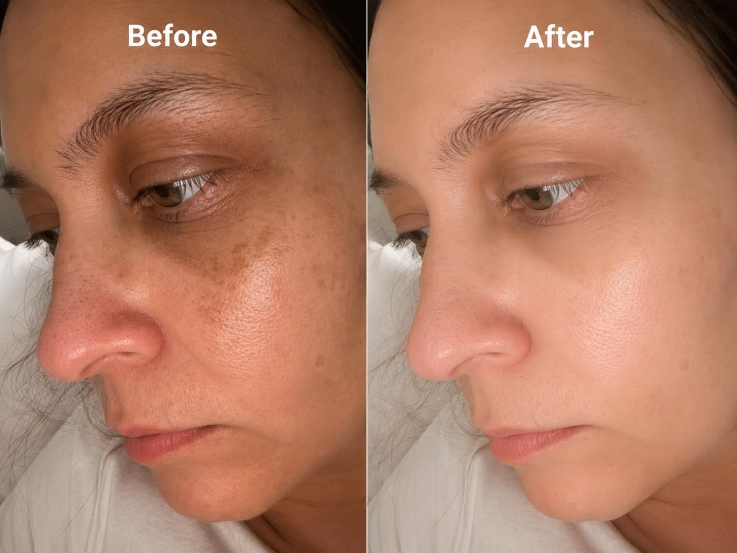 La Roche-Posay Pure 12% Vitamin C Serum For Face With Hyaluronic Acid & Salicylic Acid, Hydrating Face Serum, Boost Radiance & Reduce Wrinkles customer photo 2