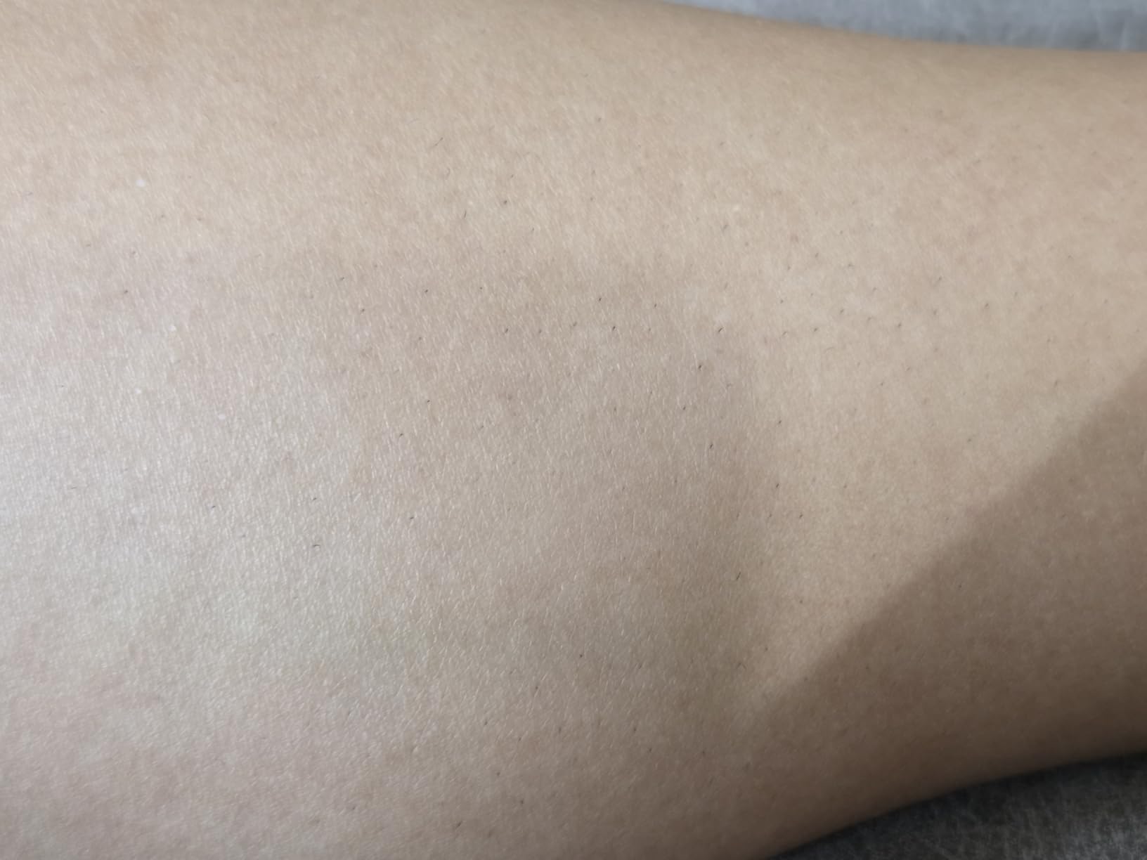 Braun IPL, Silk-Expert Pro 5, IPL Hair Removal for Women and Men, Permanent Laser Hair Reduction At-Home, 2 Heads, Pouch, IPL5137 customer photo 2