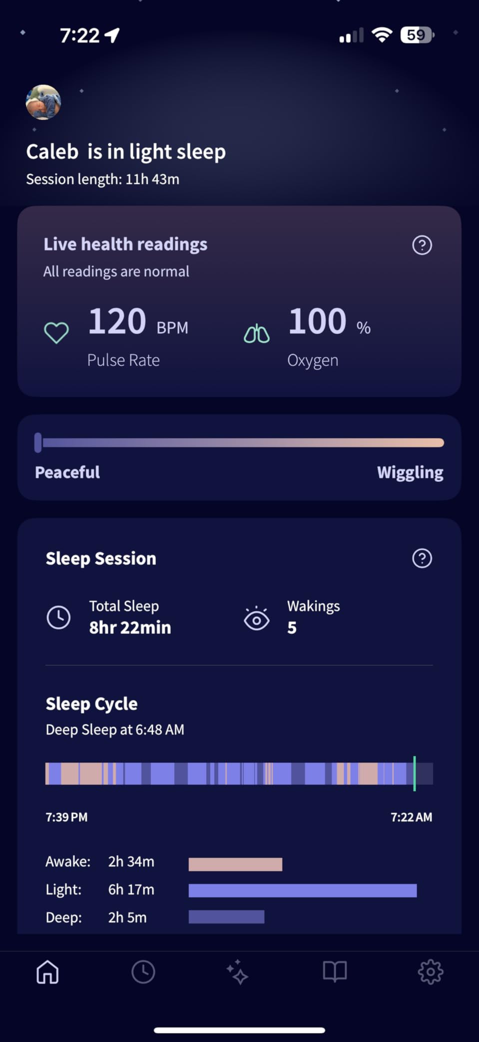 Dream Sock Smart Wearable Baby Monitor Tracks Heart Rate & Oxygen in Real Time Parents Receive Alerts, Sleep Insights & More via App - Bedtime Blue customer photo 2