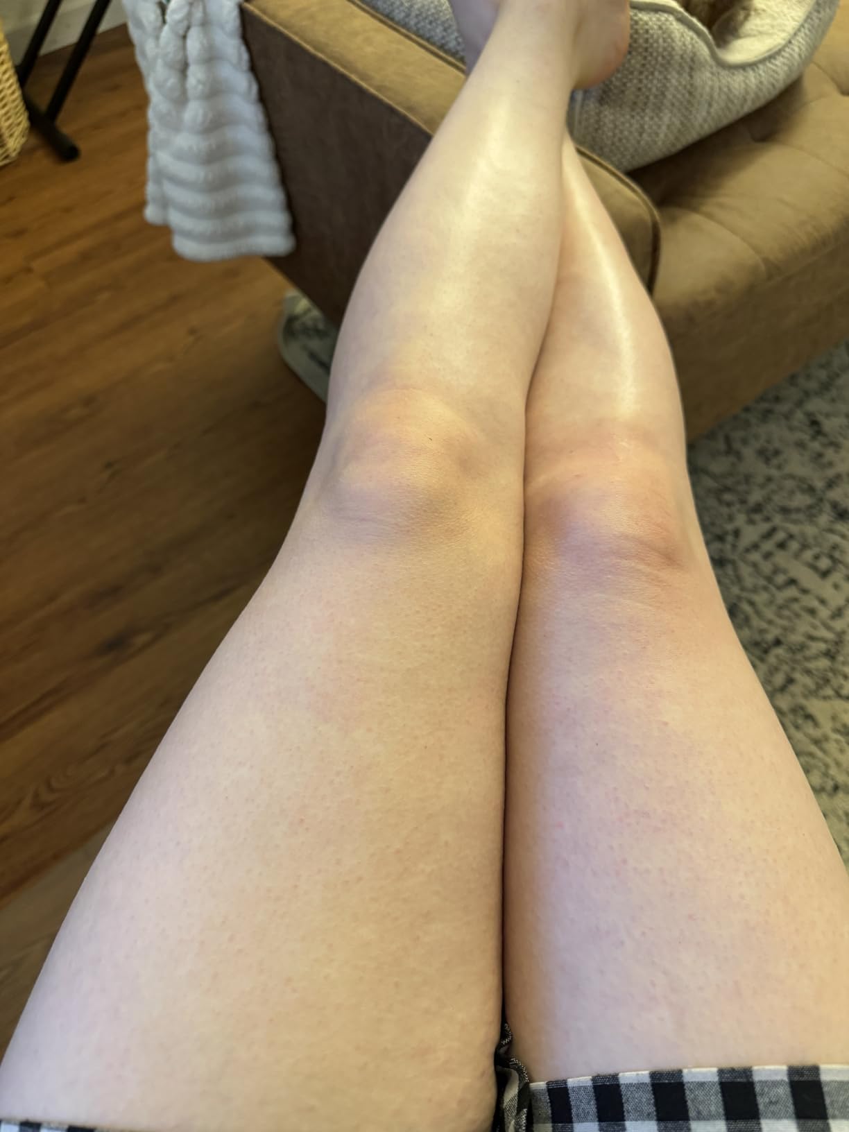 Philips Epilator Series 2000, Corded Epilator for Legs and Body, Hair Removal Device for Women, Model BRE227/00 customer photo 2