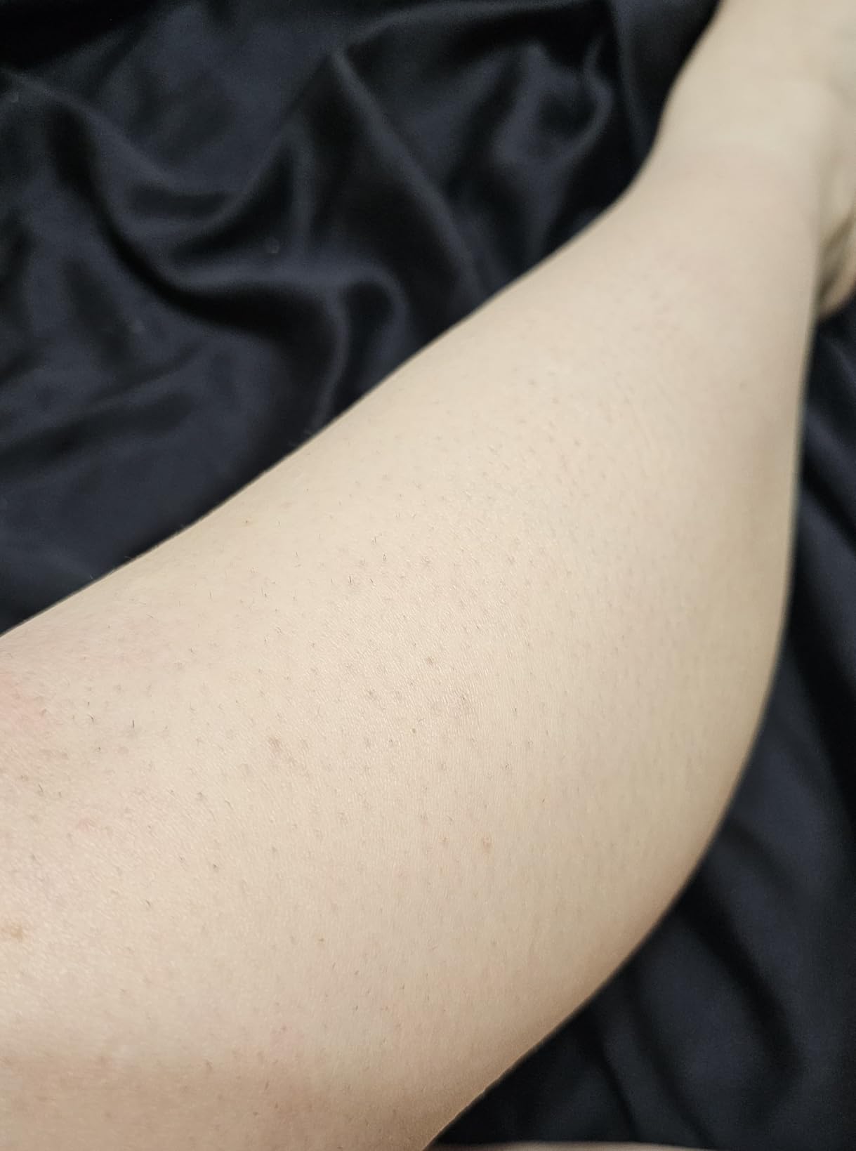 Philips Lumea 9000 Series IPL Hair Removal Device Permanent Laser Hair Reduction for Women & Men, Easy and Comfortable Use at Home, SenseIQ, 4 Attachments, BRI984/03 customer photo 2