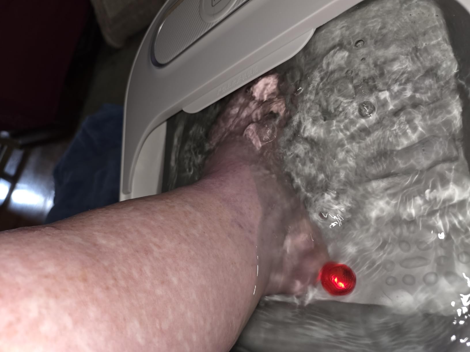UNIFULL Collapsible Foot Spa Bath with Heat and Remote Control, Temperature Control, Shiatsu Rollers, Bubble Jets, Foot Pedicure Kit customer photo 1