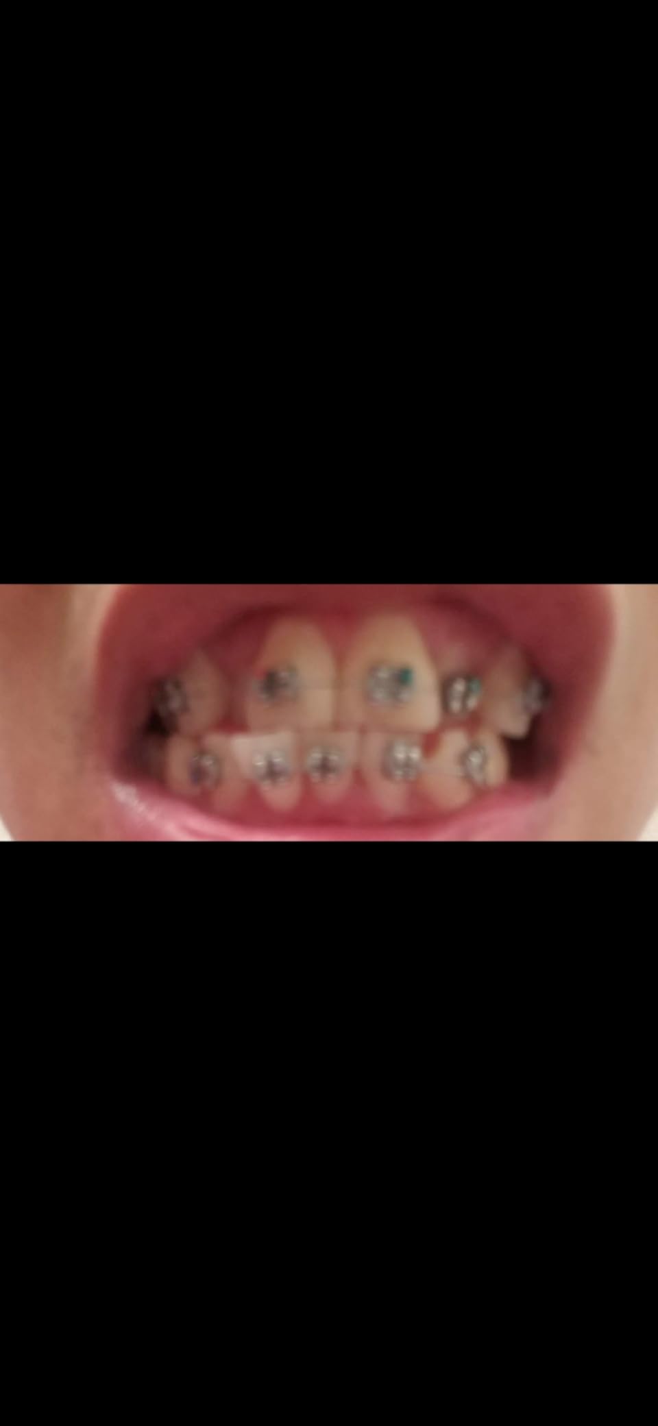 Crest 3D Whitestrips Sensitive & Gentle + LED Light - Teeth Whitening Kit, 1 Light + 14 Treatments, Each with 1 Upper/1Lower, 28 Strips customer photo 2